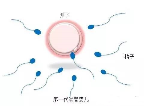 高龄二胎成功案例